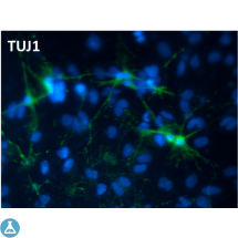 Anti-Beta-tubulin antibody[STJ97037]