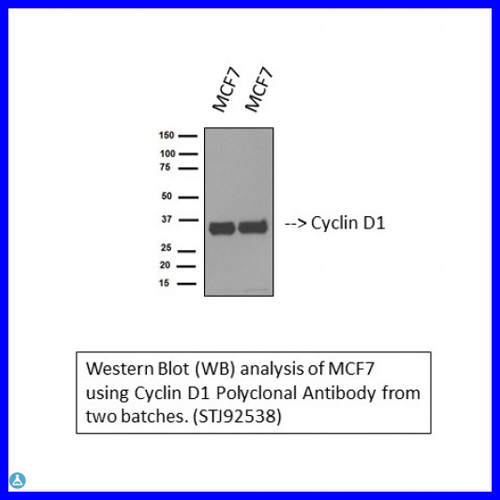 Anti-Cyclin D1 antibody【STJ92538】