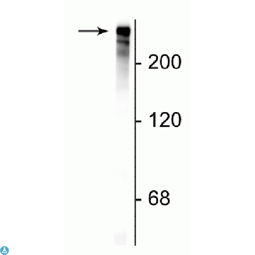 Anti-MAP2 antibody[STJ120119]