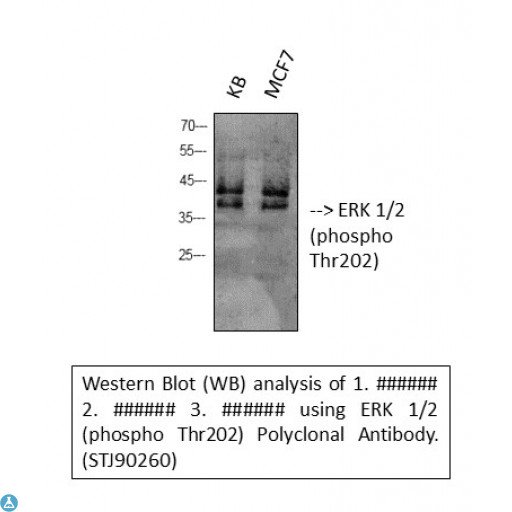 Anti-Phospho-ERK 1/2 (T202) antibody[STJ90260]