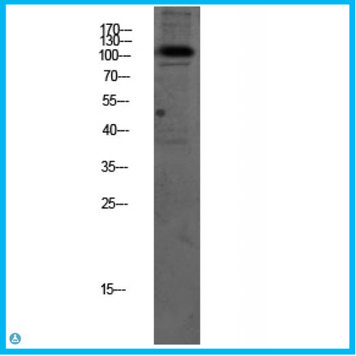 Anti-Na+/K+-ATPase Alpha antibody[STJ99661]