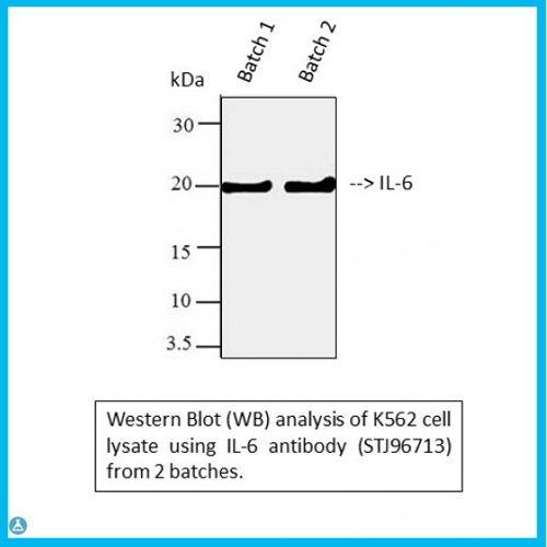 Anti-IL-6 antibody[STJ96713]