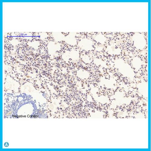 Anti-Bcl-2 antibody[STJ98587]