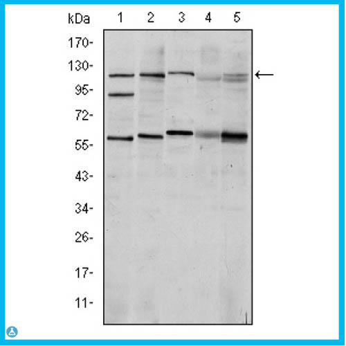 Anti-HIF-Alpha antibody[STJ98135]