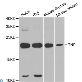 Anti-TNF Antibody[ST
