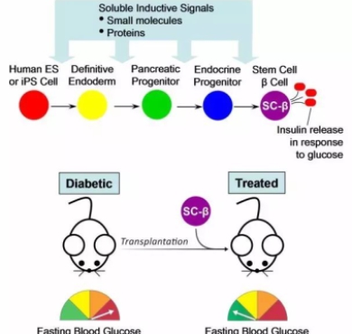 治愈糖尿病的新希望：胰岛细胞微囊化