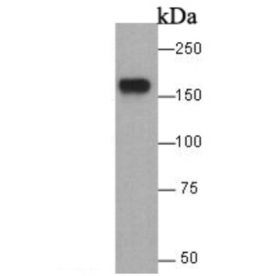 <strong>EGFR Rabbit Polyclonal An</strong>