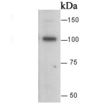 <strong>E Cadherin Rabbit Polyclo</strong>