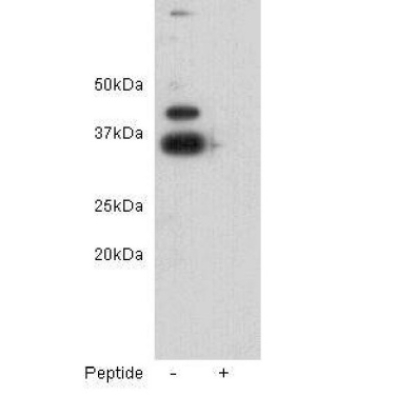 <strong>ZFP-42/REX-1 Rabbit Polyc</strong>