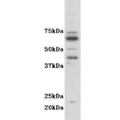 <strong>GM-CSF-R-alpha (CD116) Ra</strong>