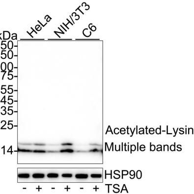 <strong>Acetylated-Lysine Recombi</strong>